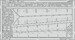 Detailset North American F100F Super Sabre Slats (Trumpeter) 32-459